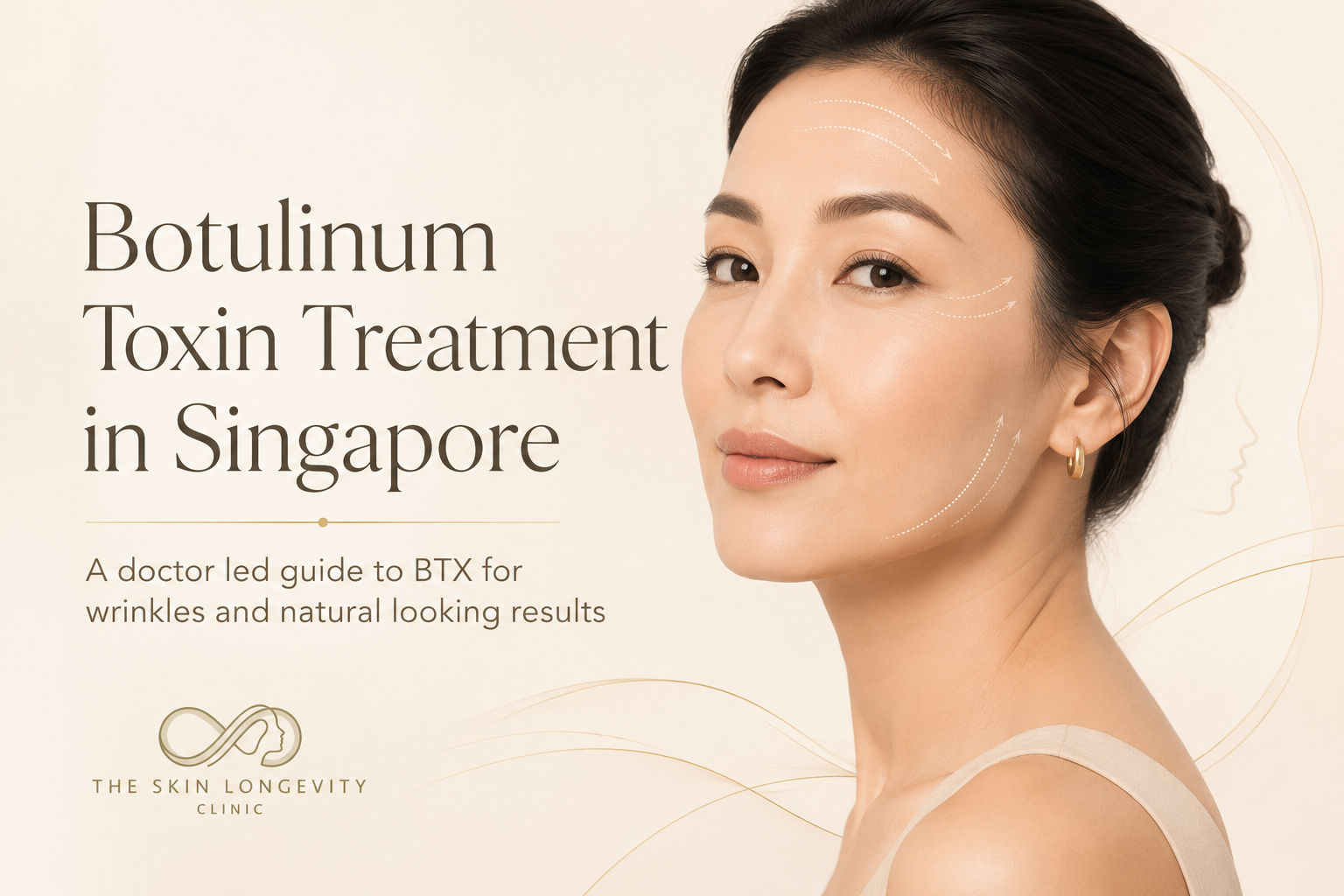 Botulinum toxin treatment in Singapore for BTX wrinkles and natural looking results