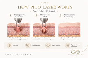 How pico laser works for pigment fragmentation and acne scar remodelling