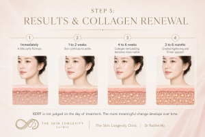 XERF results timeline showing collagen renewal from immediately after treatment to 6 months