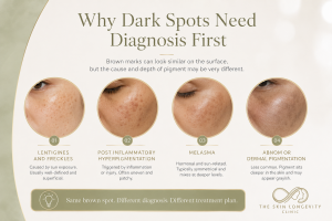 Dark spots diagnosis before PRX Plus treatment showing PIH, lentigines, melasma and dermal pigmentation