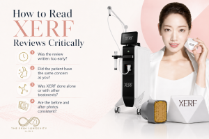 How to read XERF reviews critically before choosing skin tightening treatment
