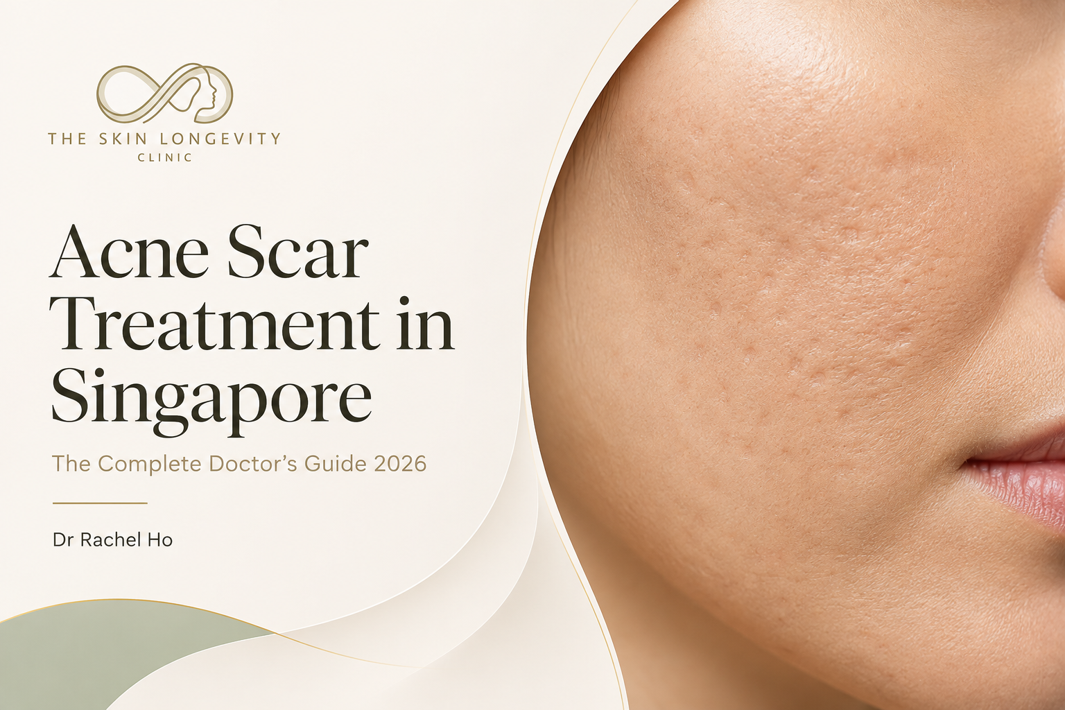 Hyperrealistic close-up of an Asian cheek with mixed atrophic acne scars beside the title Acne Scar Treatment in Singapore.