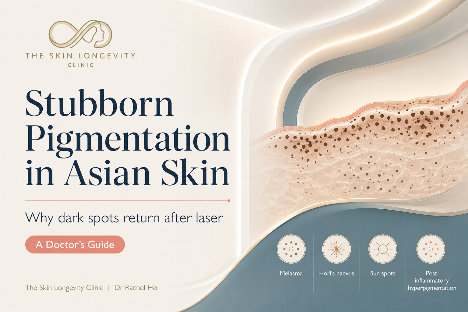Stubborn cheek pigmentation in Asian skin showing melasma, Hori’s naevus, sun spots and PIH at different depths