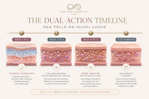 Timeline infographic showing how Juvelook PDLLA-HA skin booster results develop over time, from early hydration to progressive collagen renewal and maintenance.