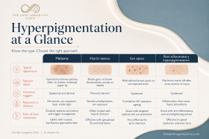 Matrix comparing melasma, Hori’s naevus, sun spots and PIH by appearance, depth, triggers, skincare and laser role