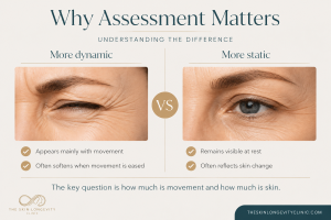 Side by side comparison of a more dynamic wrinkle and a more static wrinkle with key differences listed below.