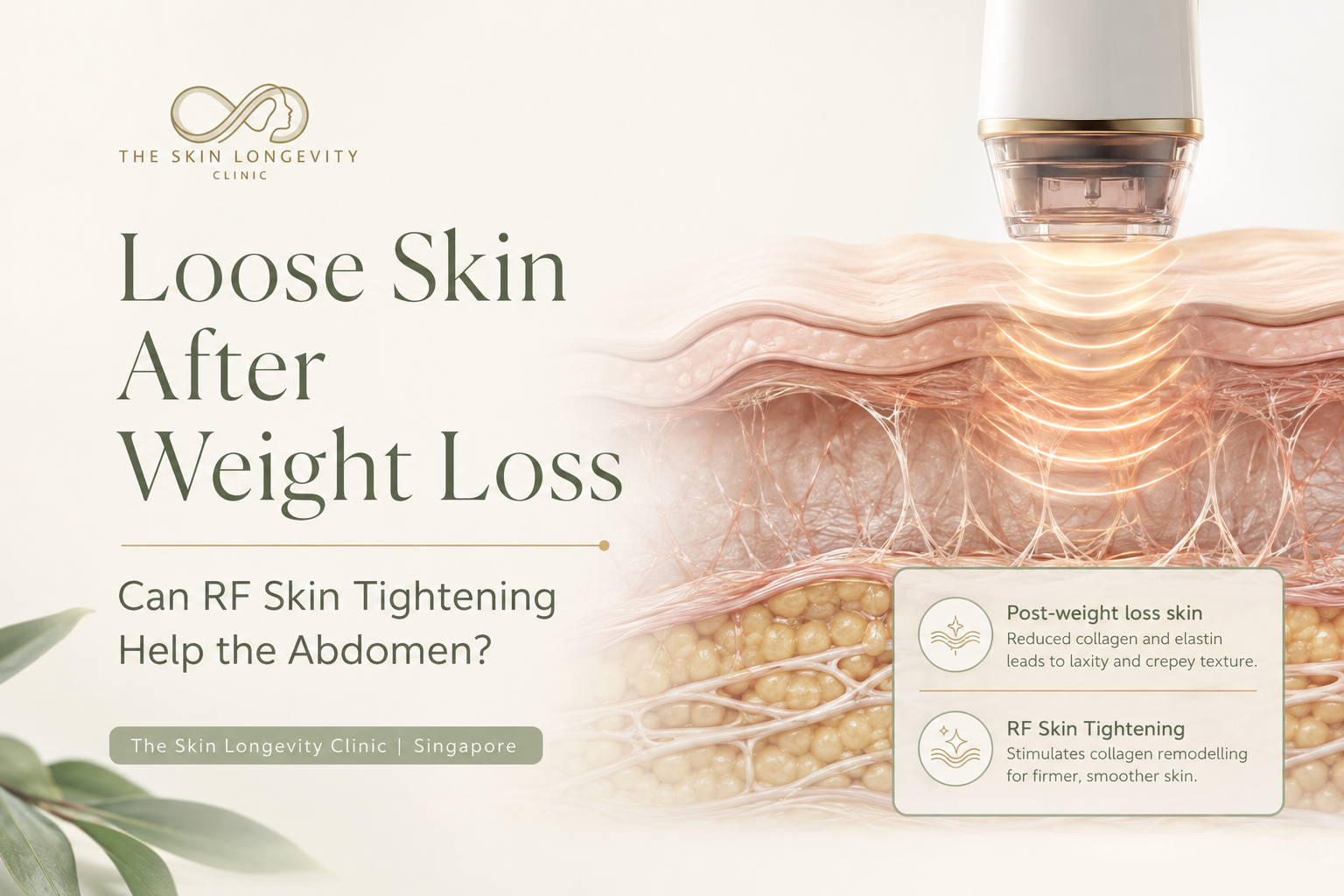 Medical illustration of XERF radiofrequency treatment delivering controlled energy into loose abdominal skin after weight loss.