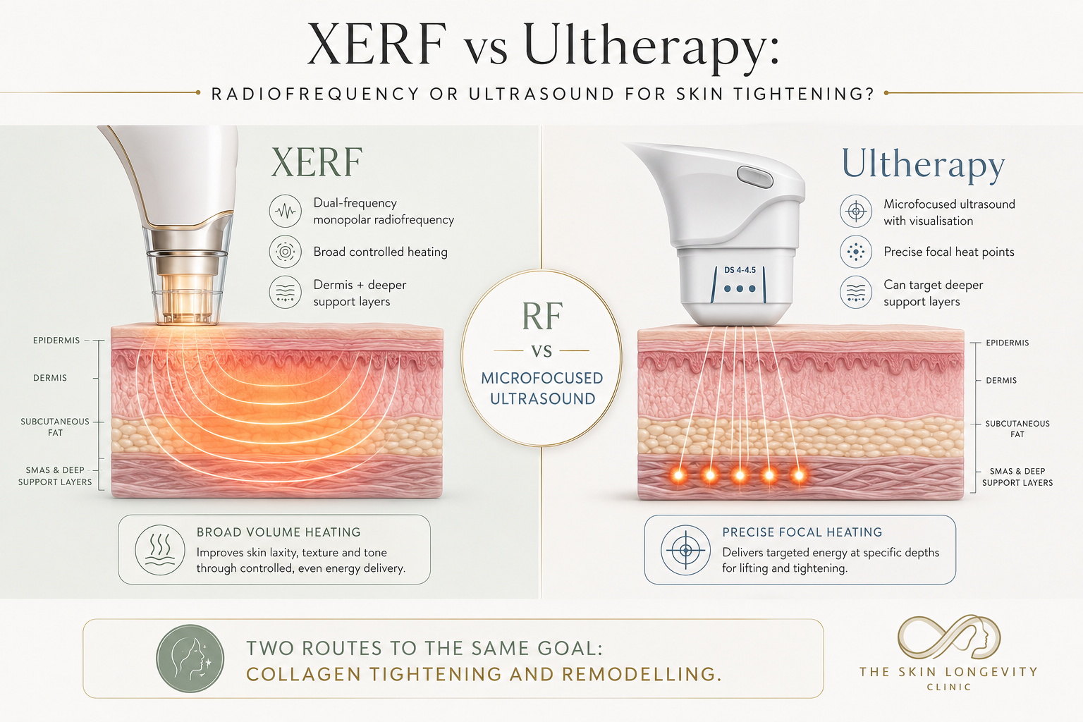 XERF and Ultherapy comparison showing radiofrequency heating, microfocused ultrasound, treatment depth and collagen remodelling.