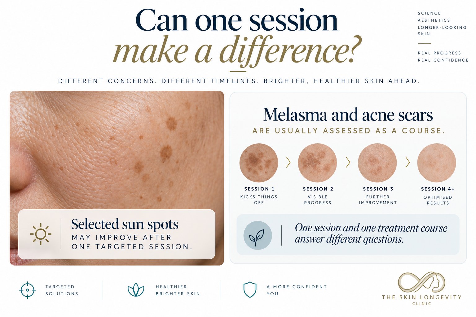 Can one pico laser session make a difference: selected sun spots may improve after one targeted session, while melasma and acne scars are usually assessed as a course
