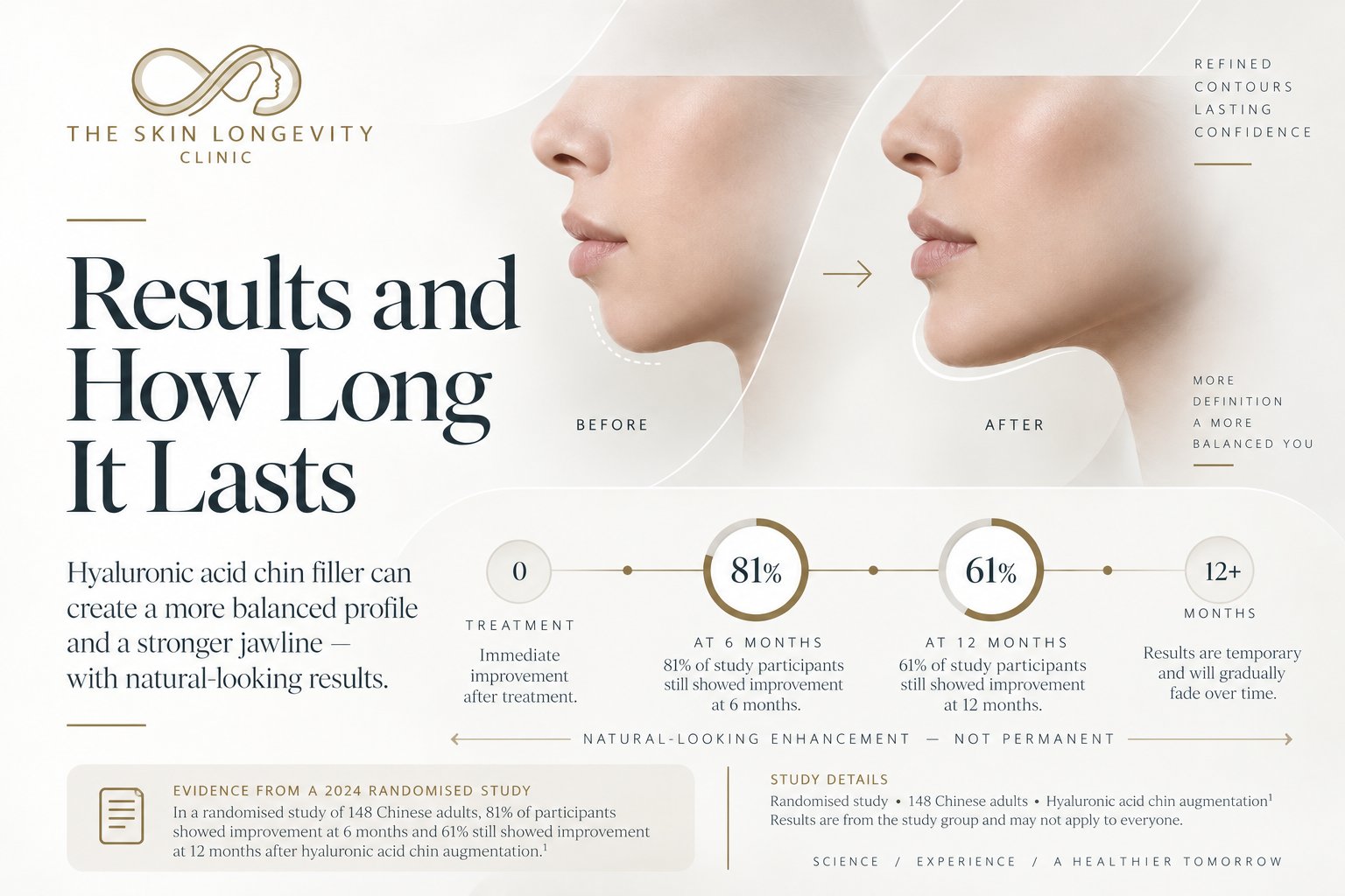 Chin filler results and how long they last: 81% of participants improved at 6 months and 61% at 12 months in a 2024 randomised study of hyaluronic acid chin augmentation