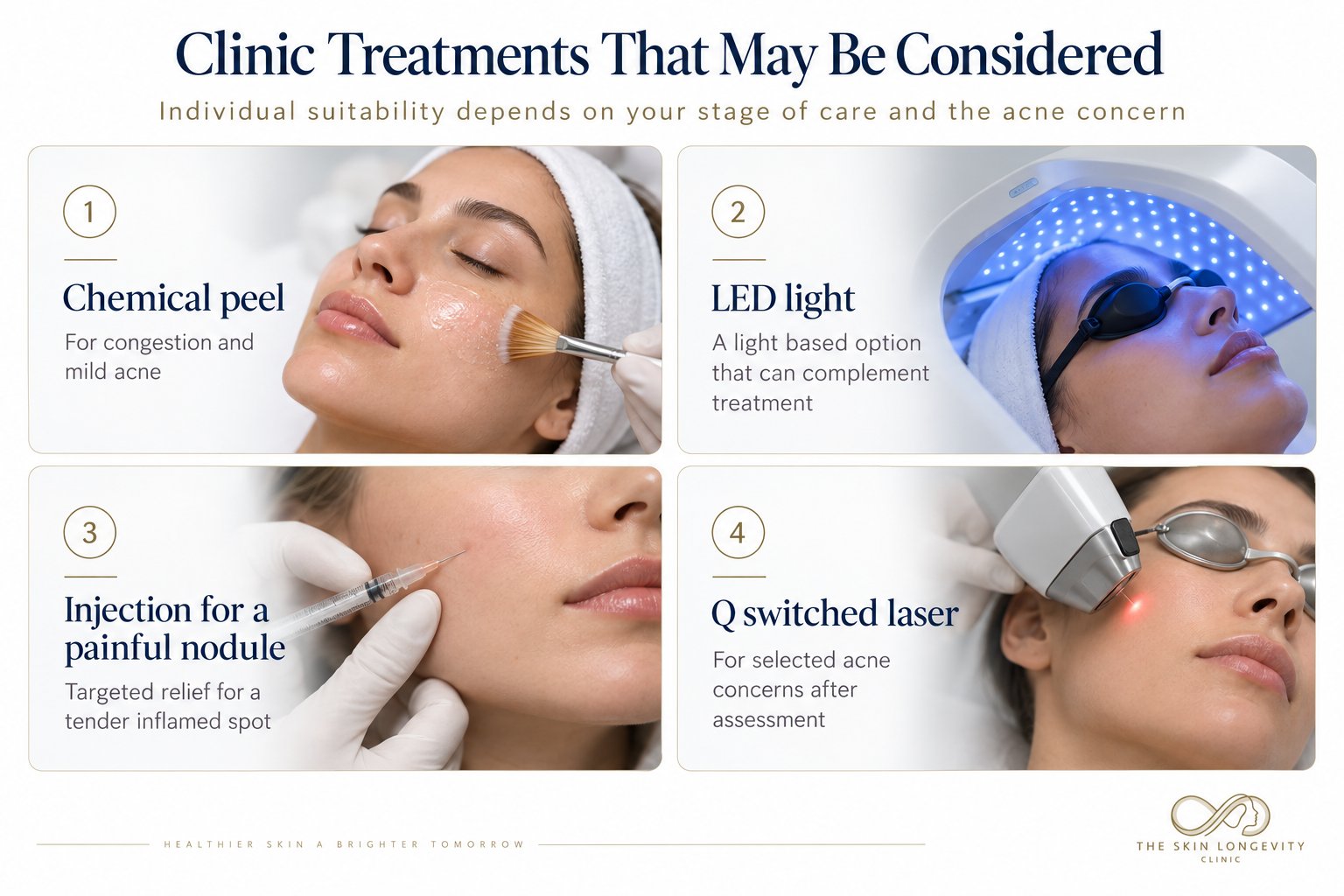 Clinic acne treatments that may be considered during pregnancy or fertility treatment: chemical peel, LED light, injection for a painful nodule and Q switched laser