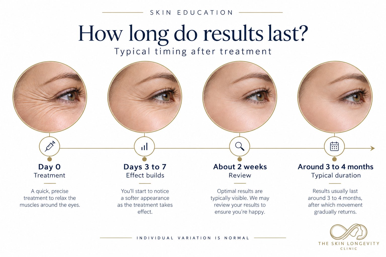 How long crow’s feet treatment results last: day 0, days 3 to 7, about 2 weeks, around 3 to 4 months