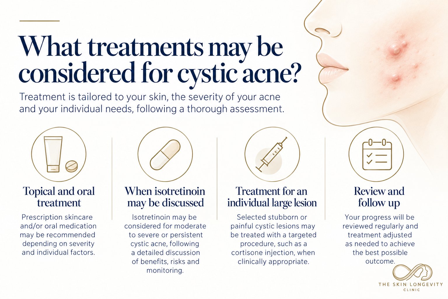 Treatments considered for cystic acne: topical and oral treatment, when isotretinoin may be discussed, cortisone injection for an individual large lesion, and review and follow up