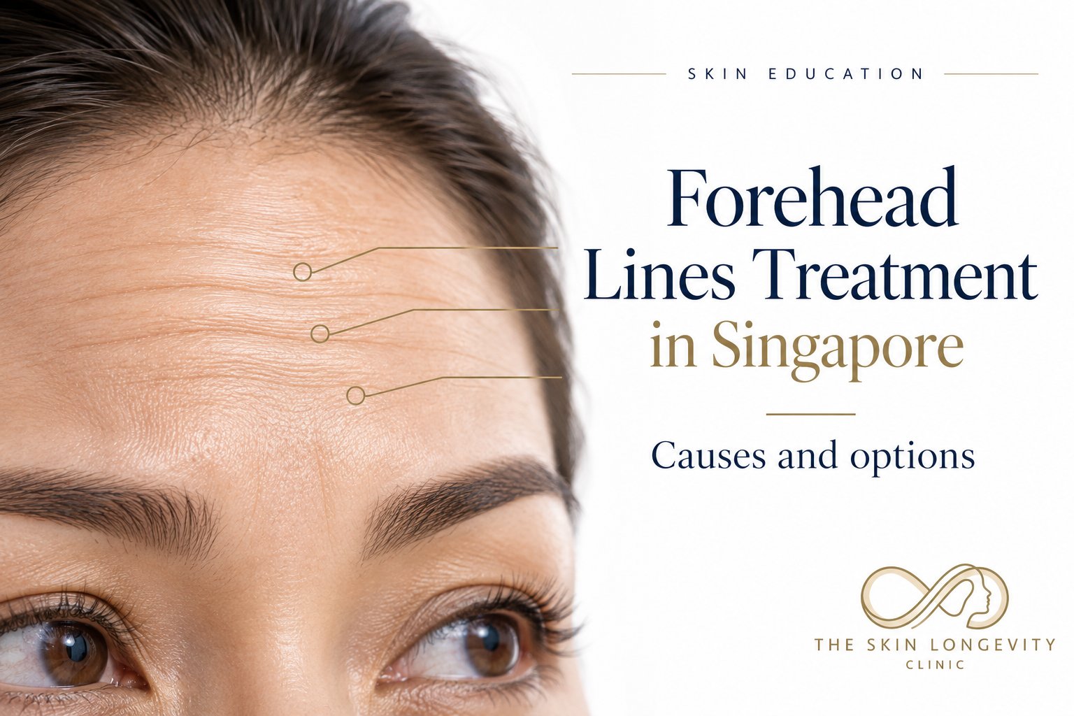 Forehead lines treatment in Singapore: causes and options, close-up of horizontal forehead lines