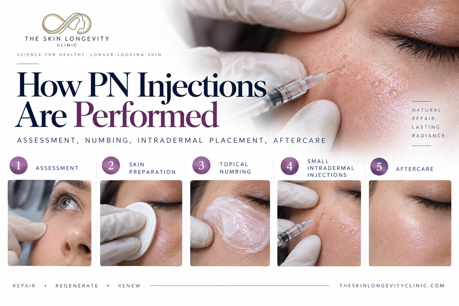 How PN injections are performed: assessment, skin preparation, topical numbing, small intradermal injections and aftercare
