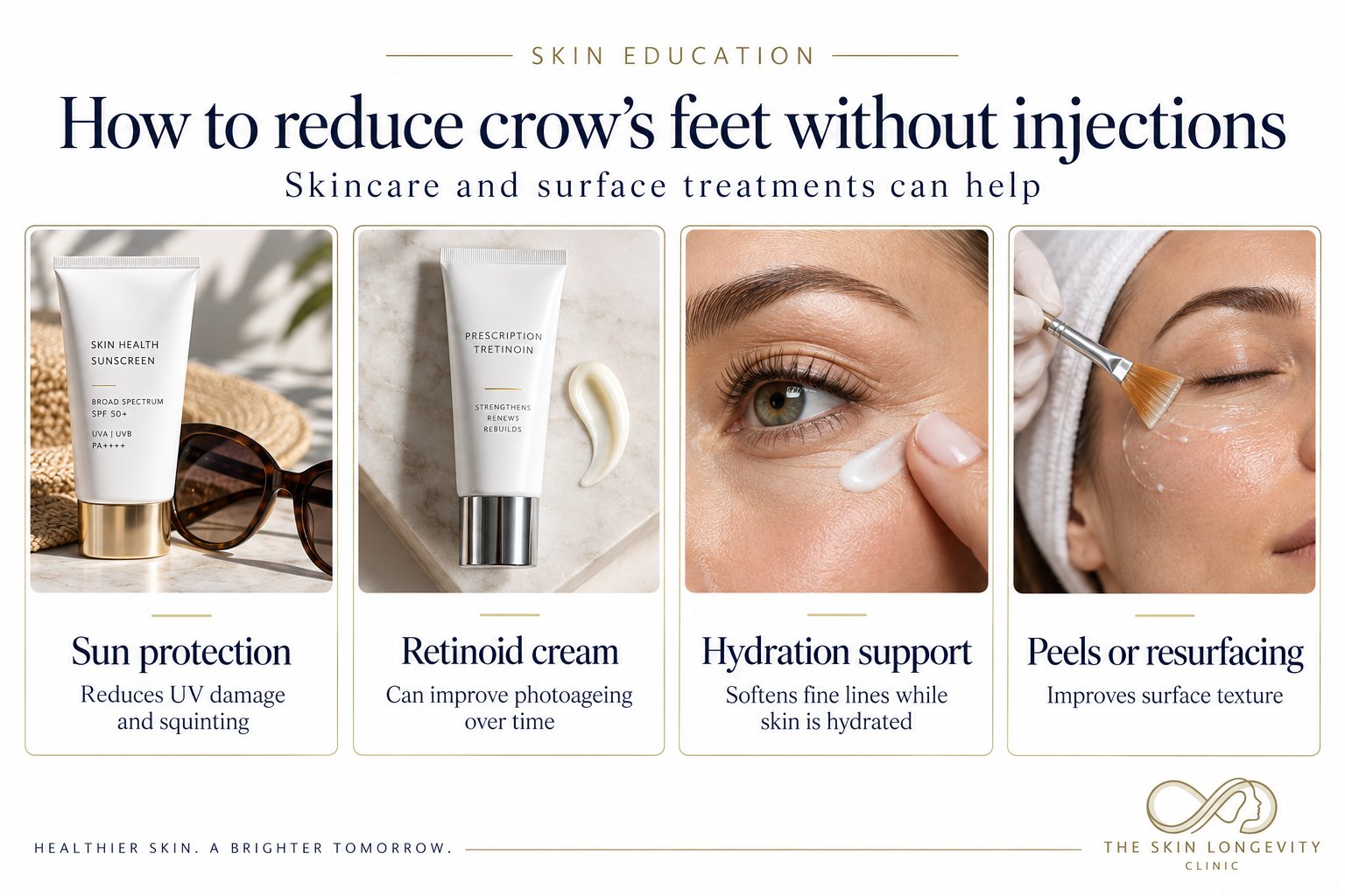 How to reduce crow’s feet without injections: sun protection, retinoid cream, hydration and peels
