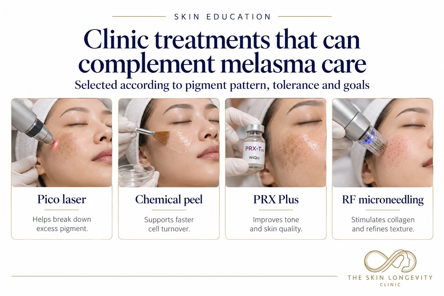 Clinic treatments that can complement melasma care in Singapore: pico laser, chemical peel, PRX Plus and RF microneedling