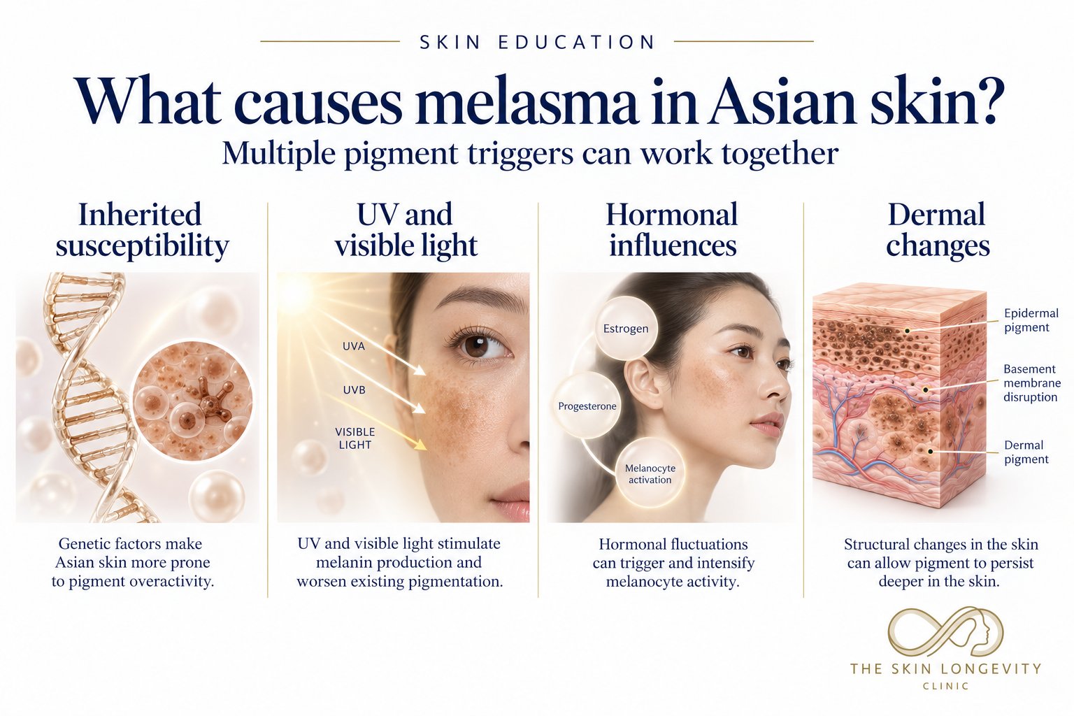 What causes melasma in Asian skin: inherited susceptibility, UV and visible light, hormonal influences and dermal changes