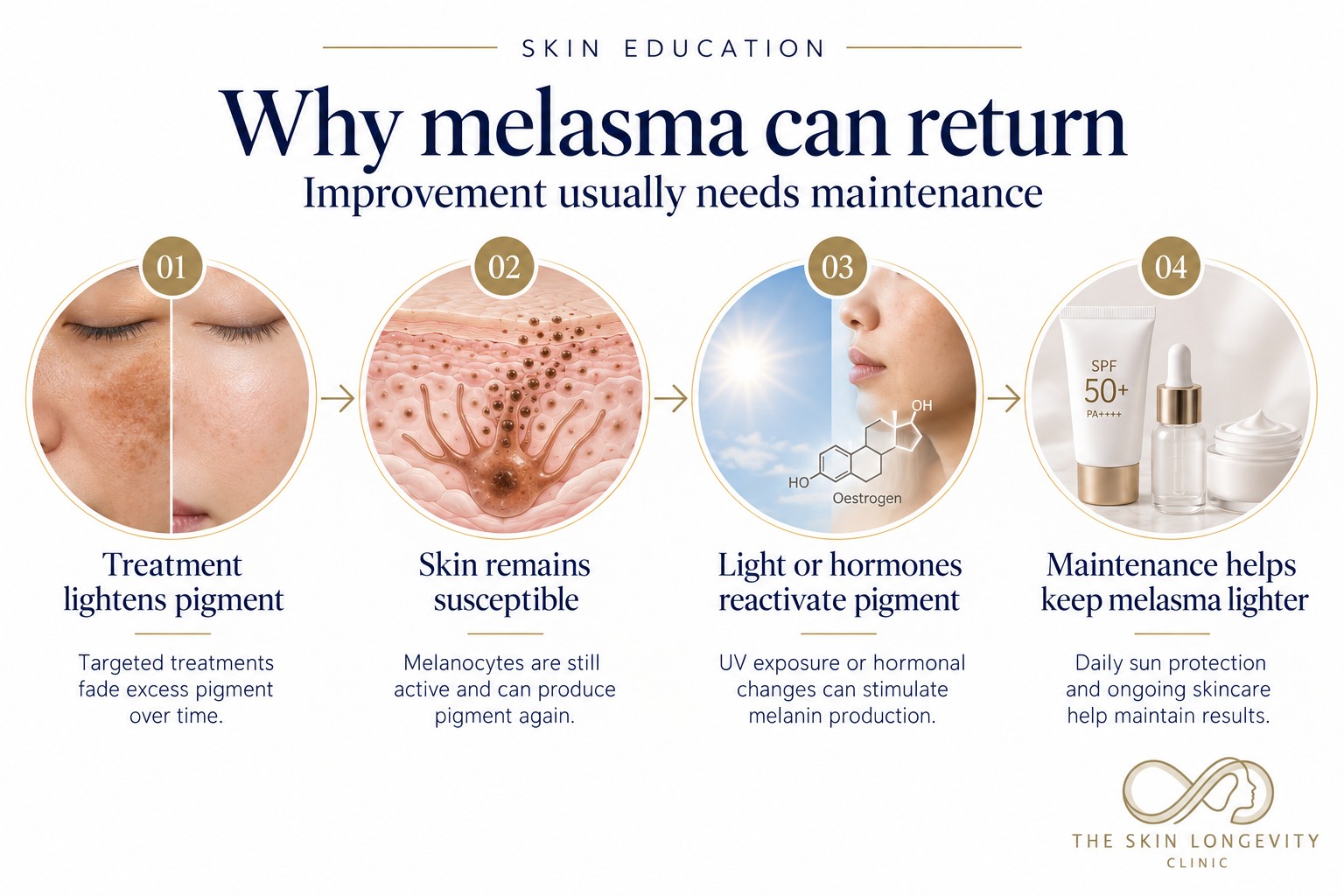 Why melasma can return after treatment: pigment lightens, melanocytes stay active, UV light or hormones reactivate pigment, and maintenance keeps melasma lighter