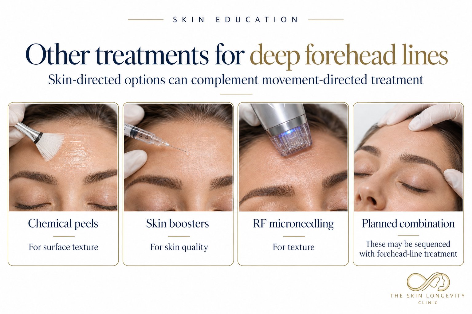 Other treatments for deep forehead lines: chemical peels, skin boosters, RF microneedling and planned combination