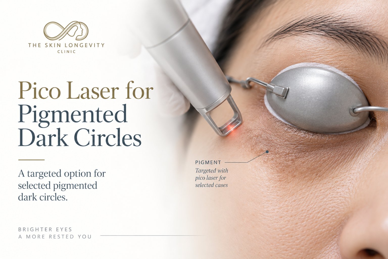 Pico laser for pigmented dark circles: a targeted option for selected pigmented dark eye circles