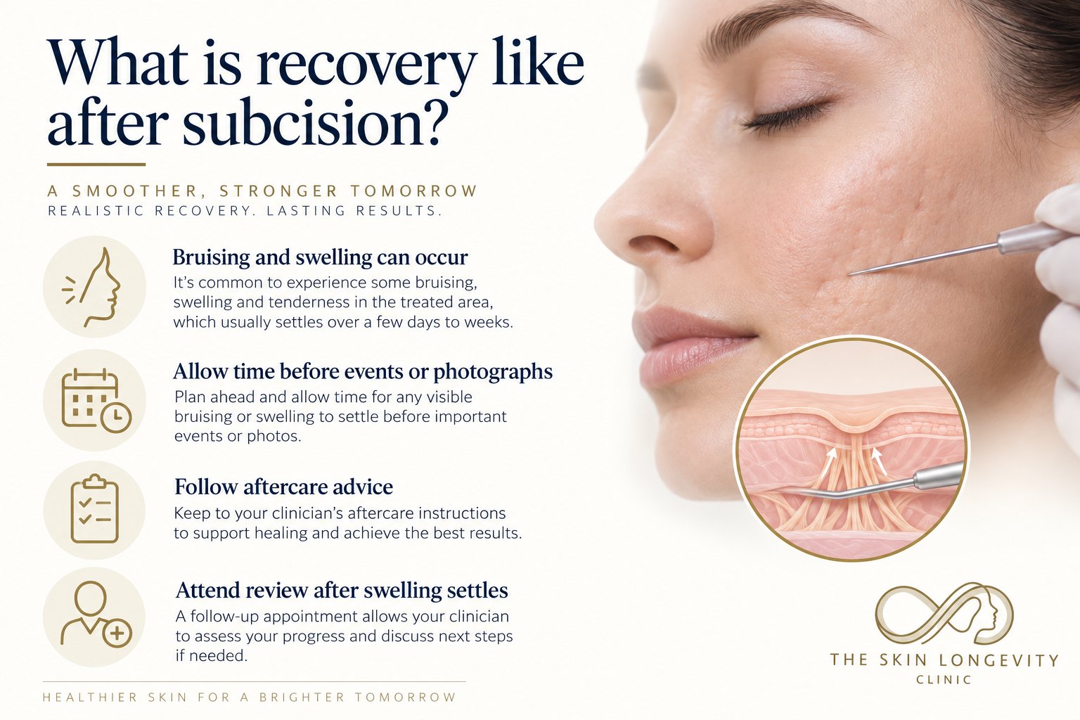 Recovery after subcision for acne scars: bruising and swelling can occur, allow time before events or photographs, follow aftercare advice and attend review after swelling settles