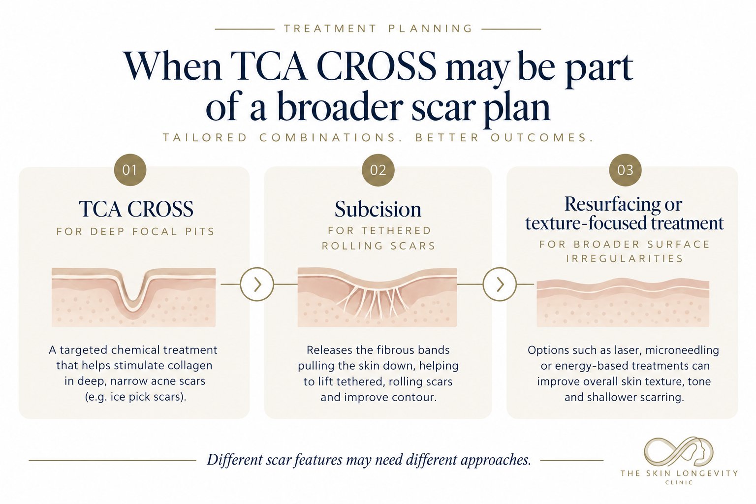 When TCA CROSS may be part of a broader acne scar plan: TCA CROSS for deep focal pits, subcision for tethered rolling scars, resurfacing or texture-focused treatment for broader surface irregularities