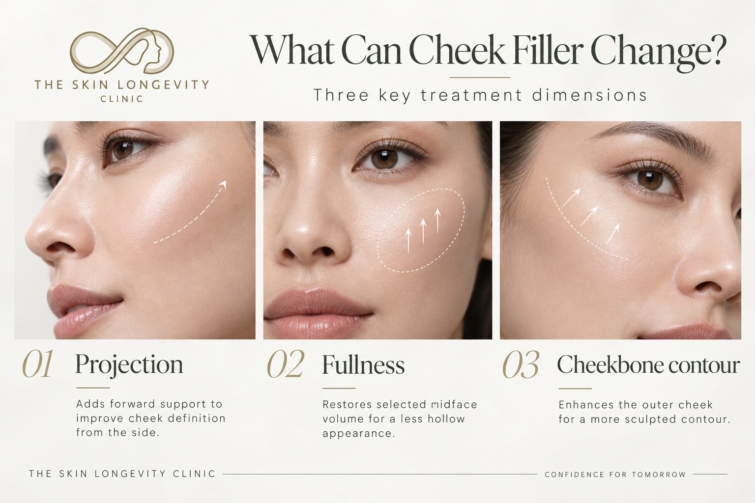 What can cheek filler change: three treatment dimensions – forward projection, midface fullness and cheekbone contour