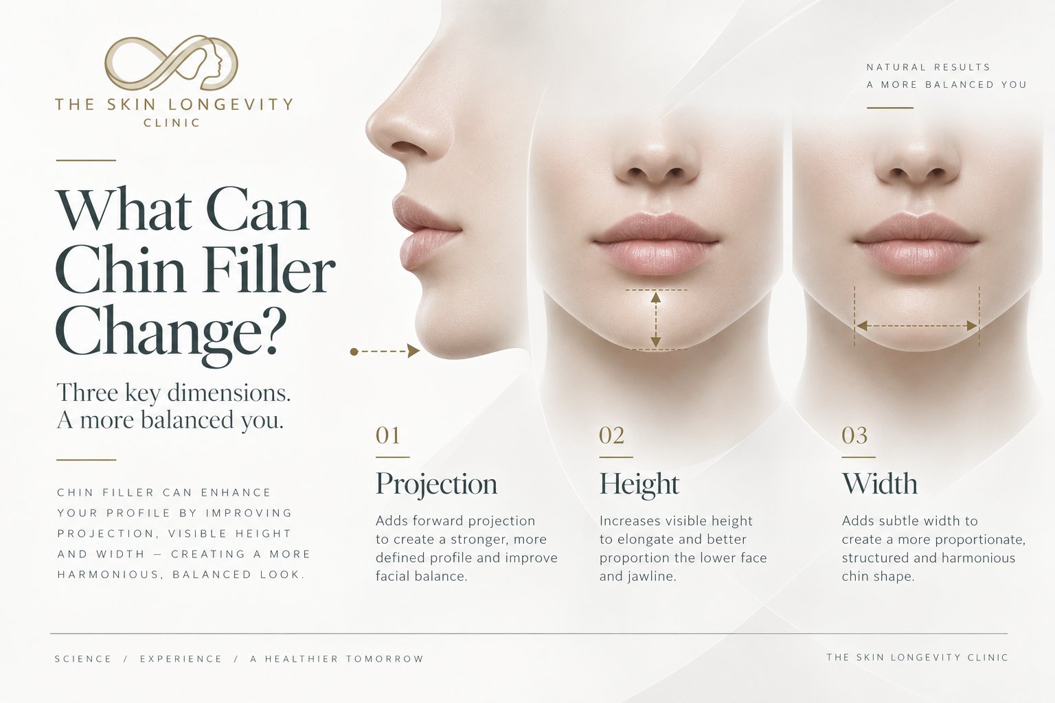 What can chin filler change: three dimensions of the chin – forward projection, visible height and width – shown on facial profiles