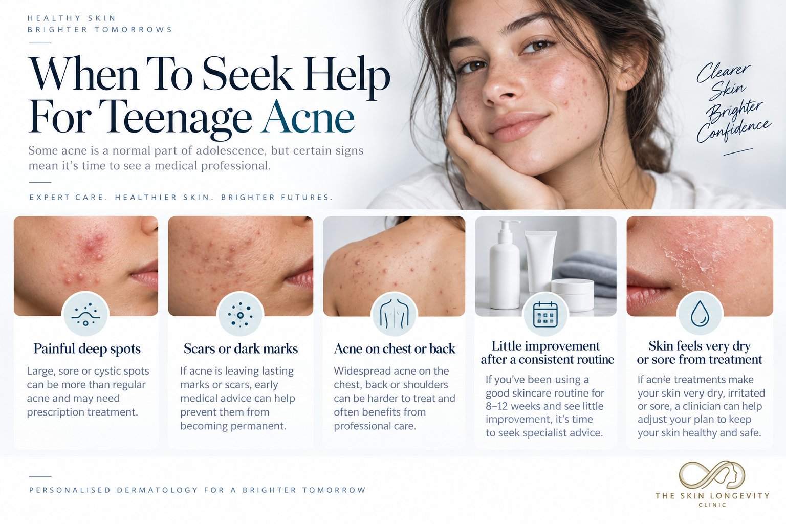 When to seek help for teenage acne: painful deep spots, scars or dark marks, acne on the chest or back, little improvement after a consistent routine, or skin that feels very dry or sore from treatment