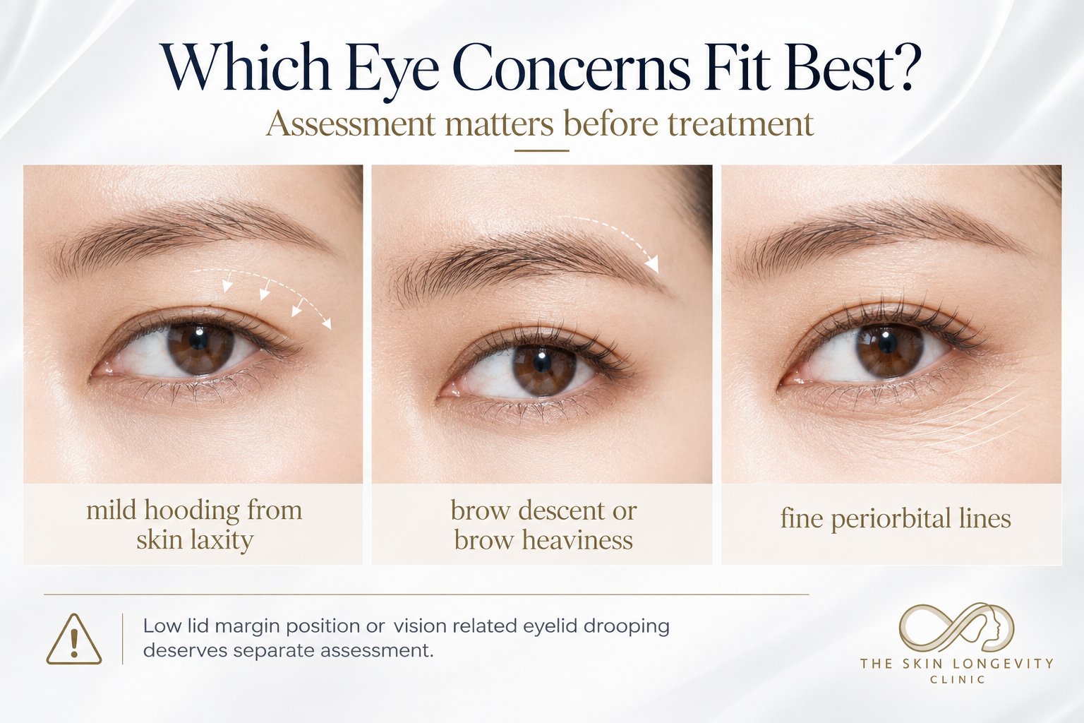 Which eye concerns fit XERF eye treatment best: mild hooding from skin laxity, brow descent or brow heaviness, and fine periorbital lines. Low lid margin position or vision-related eyelid drooping needs separate assessment.