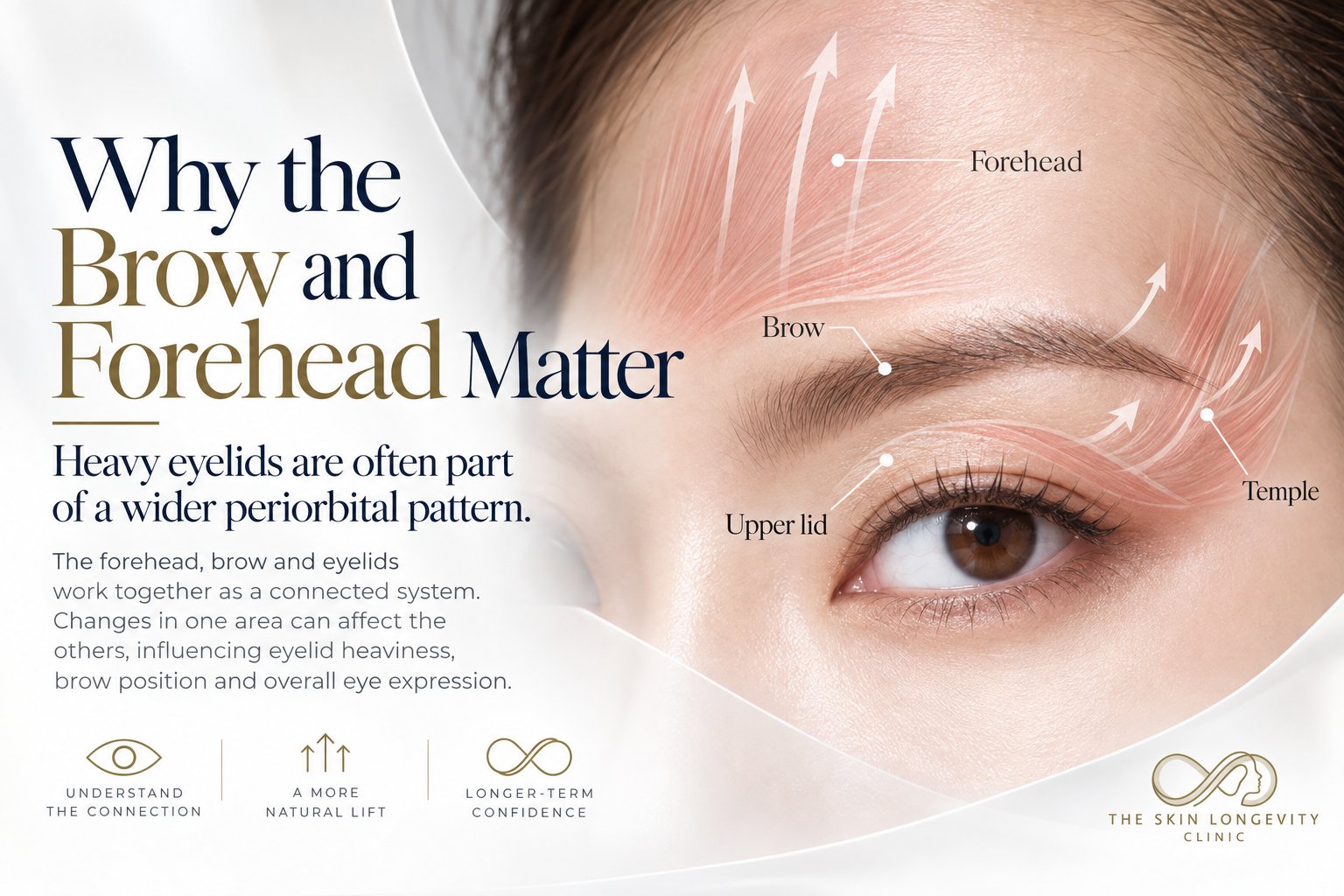Why the brow and forehead matter for heavy eyelids: the forehead, brow, upper lid and temple work as a connected system, so changes in one area affect eyelid heaviness, brow position and eye expression.