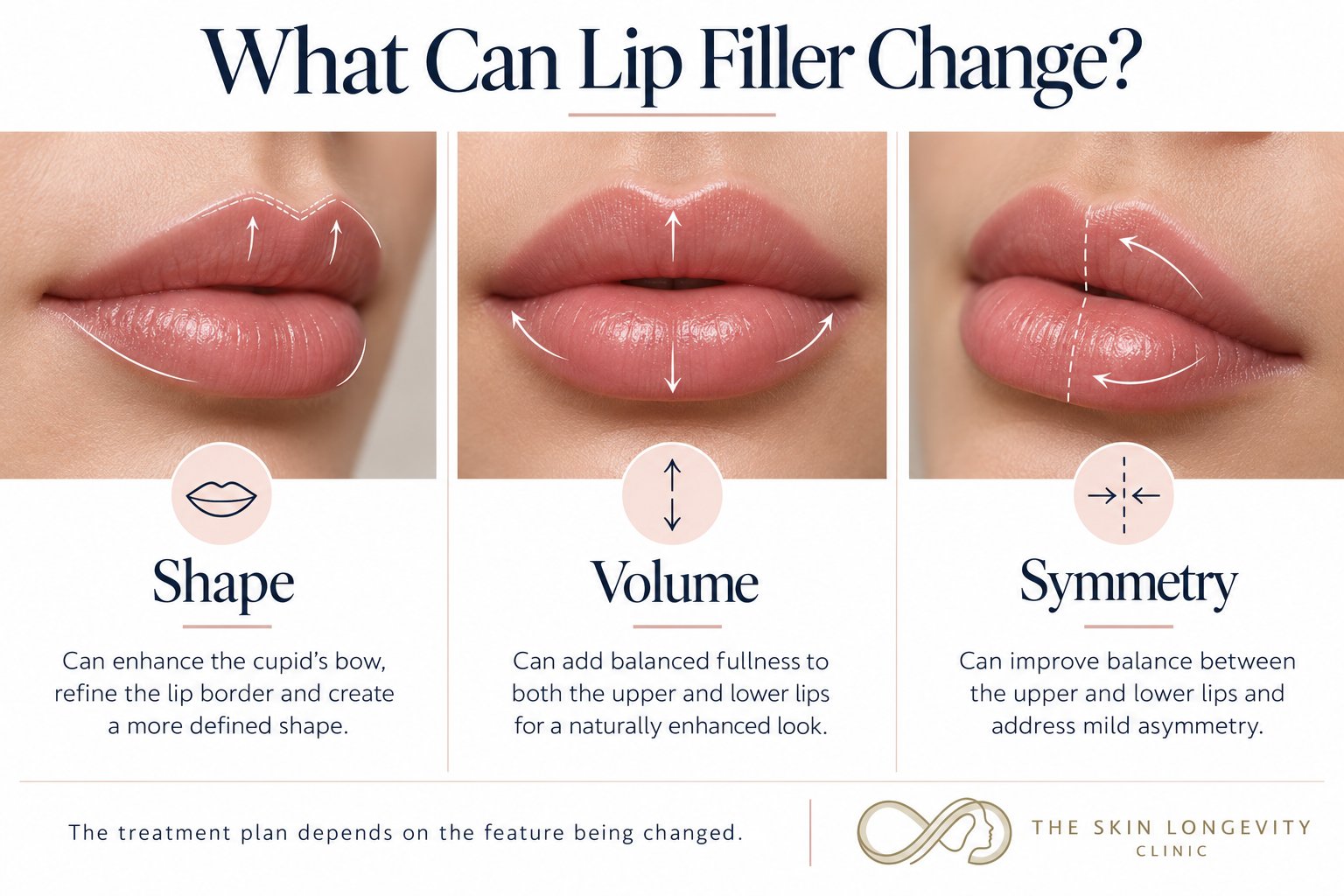 Before lip filler: Cupid's bow, lip border, projection, upper-lower balance and cold sore history