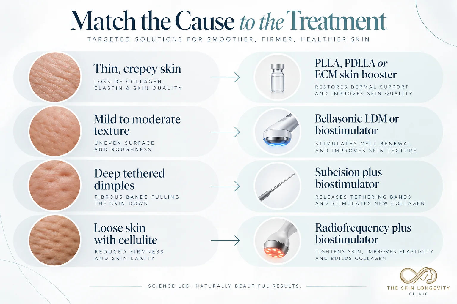 Best cellulite treatment: matching thin skin, texture, tethered dimples and loose skin to the right treatment