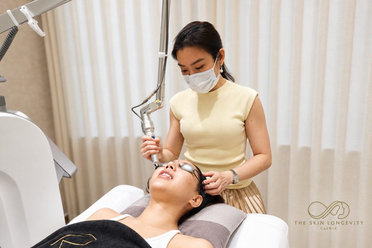 Pigmentation treatment in Singapore: Dr Rachel Ho using a pico laser on Asian skin, patient wearing eye shields