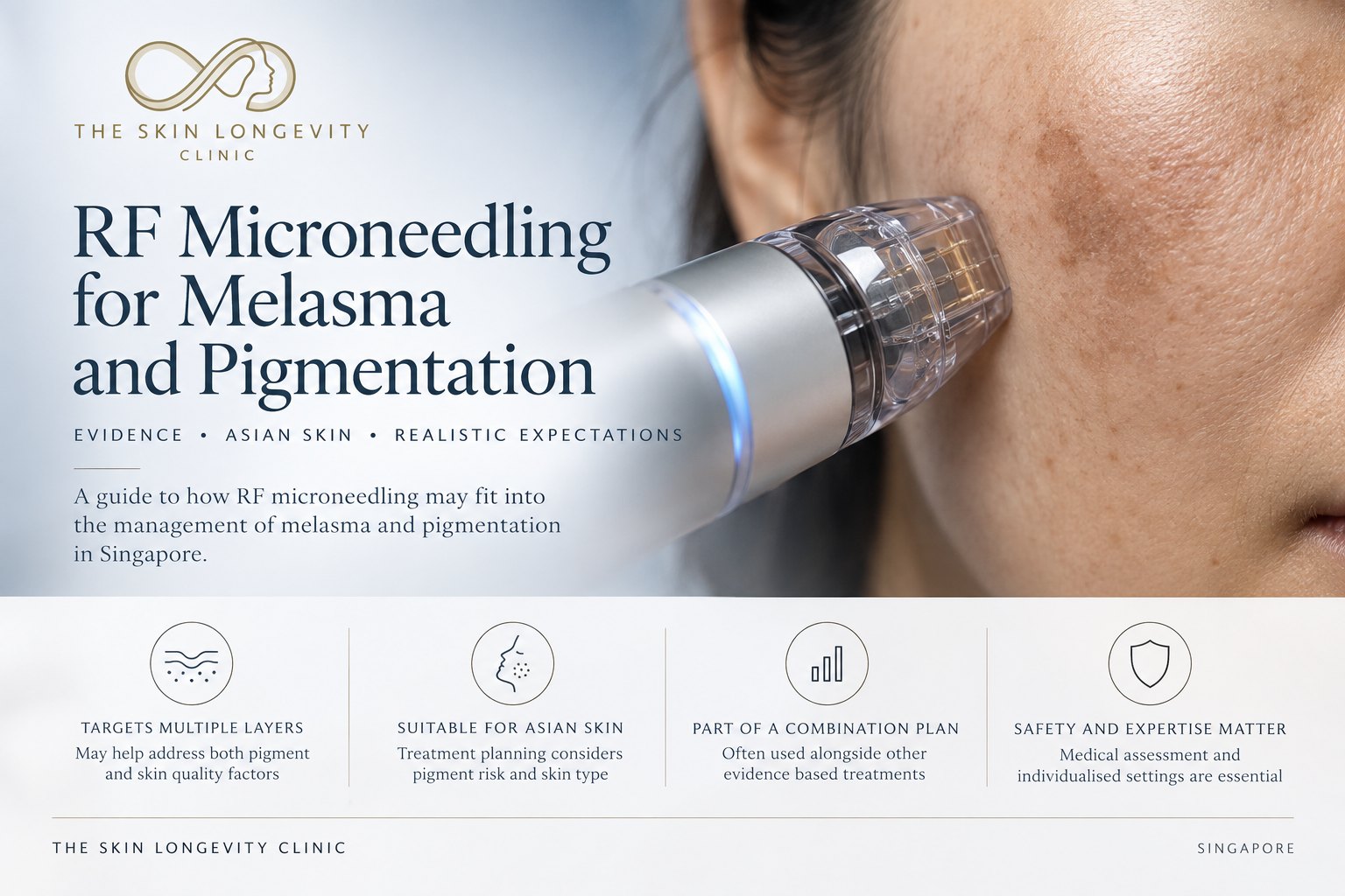 RF microneedling for melasma and pigmentation in Singapore: multiple skin layers, Asian skin planning, combination treatment and medical assessment