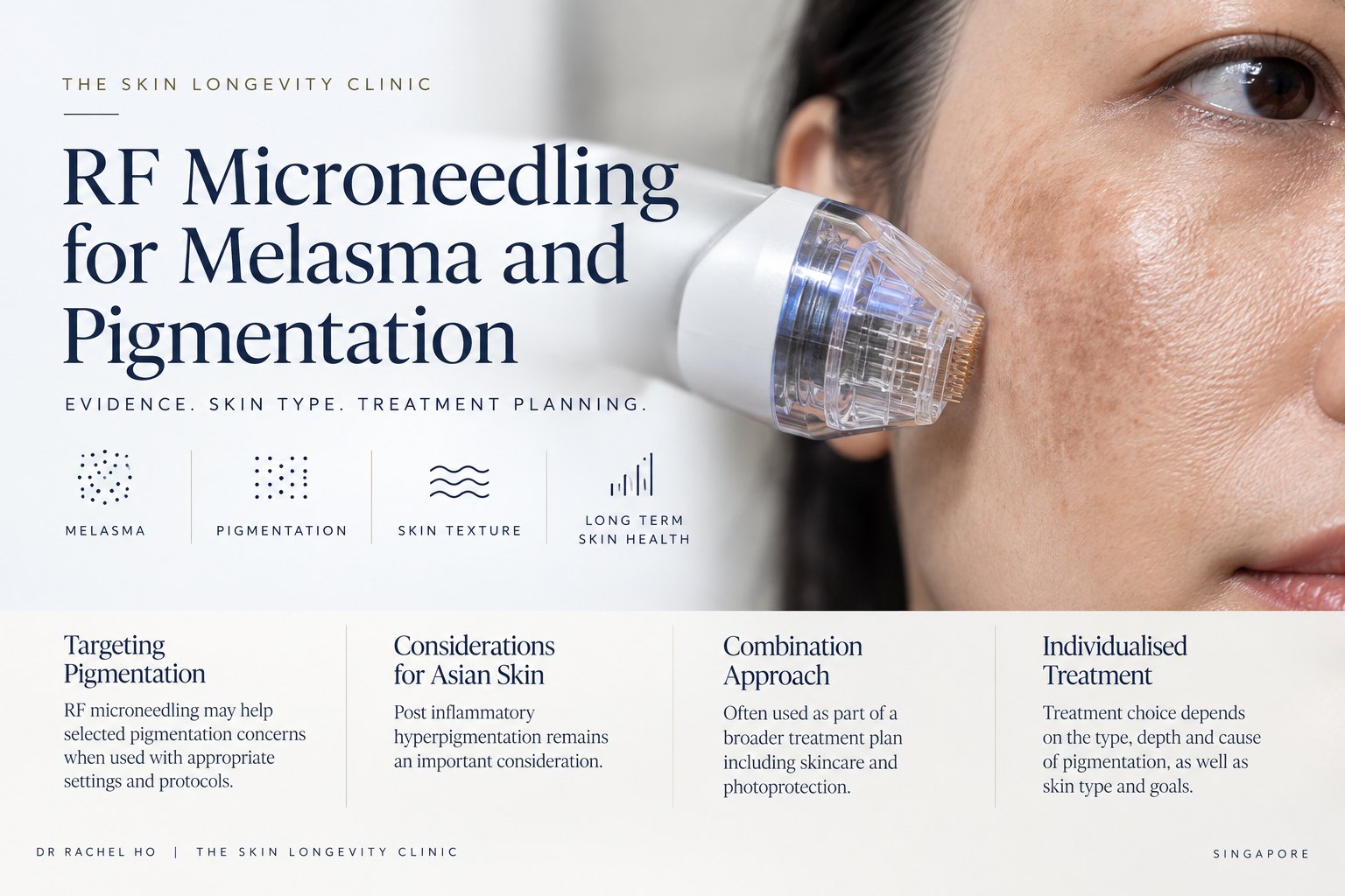 RF microneedling for melasma and pigmentation in Asian skin: post-inflammatory hyperpigmentation risk, combination approach and individualised treatment